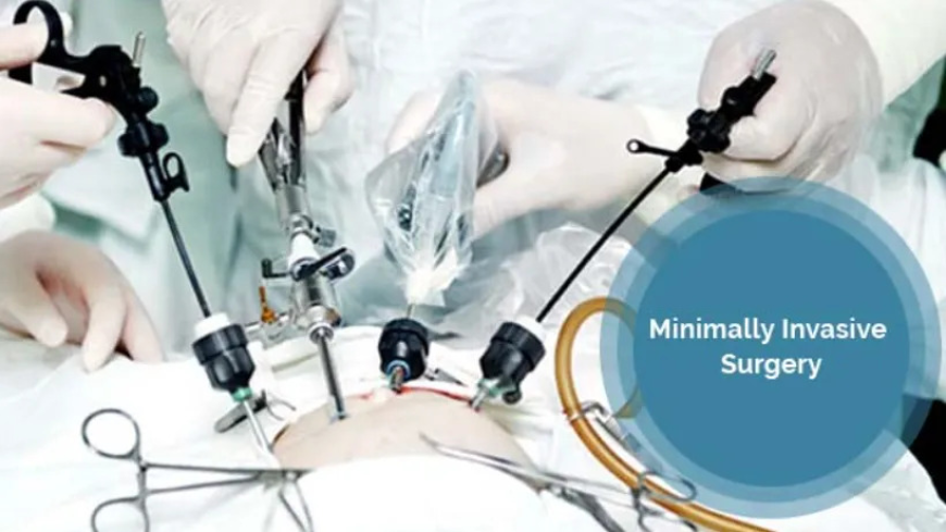 Minimally Invasive Surgical Instruments Market Overview and Key Segments