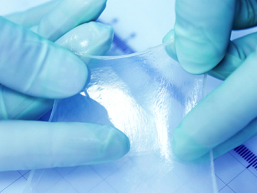 How Amniotic Membrane Grafts Revolutionize Wound Healing
