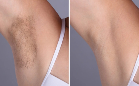 Laser Hair Removal in Dubai: The Fastest Way to Smooth Skin