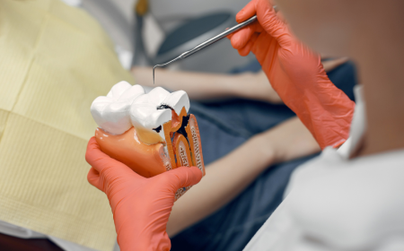 How to Find the Best Dentist for Dental Implants in Shakopee