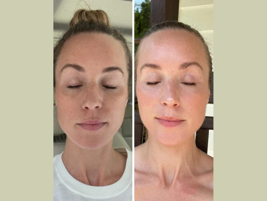 How to Choose the Best Aesthetic Clinics in Dubai Fotona 4D Laser for You