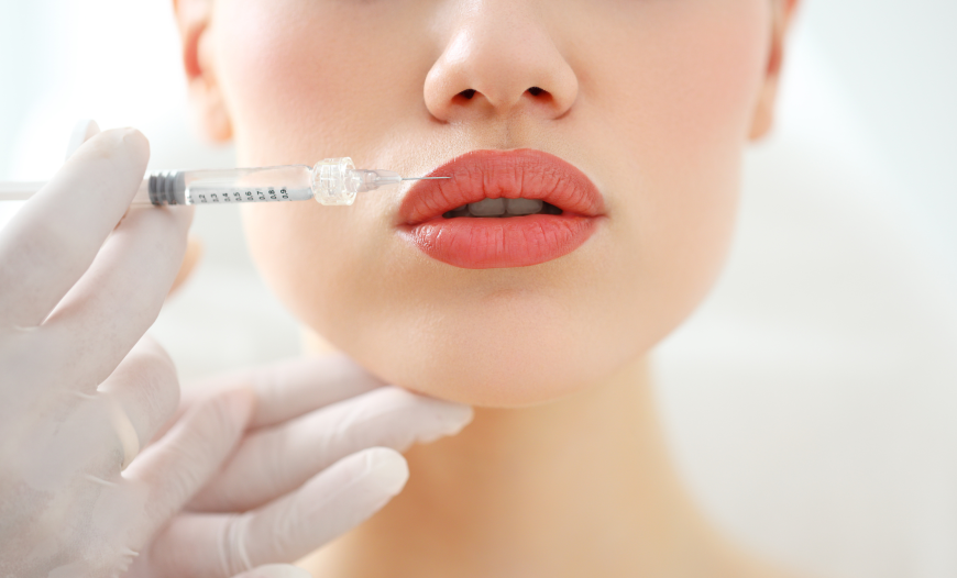 Naturally Enhanced Lips with Lip Fillers in Islamabad
