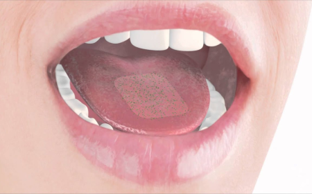 Competitive Benchmarking in the Global Oral Thin Films Market