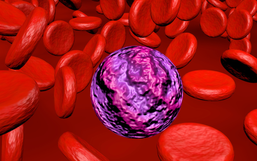 Acute Myeloid Leukemia (AML) Market Size, Trends, and Growth Opportunities