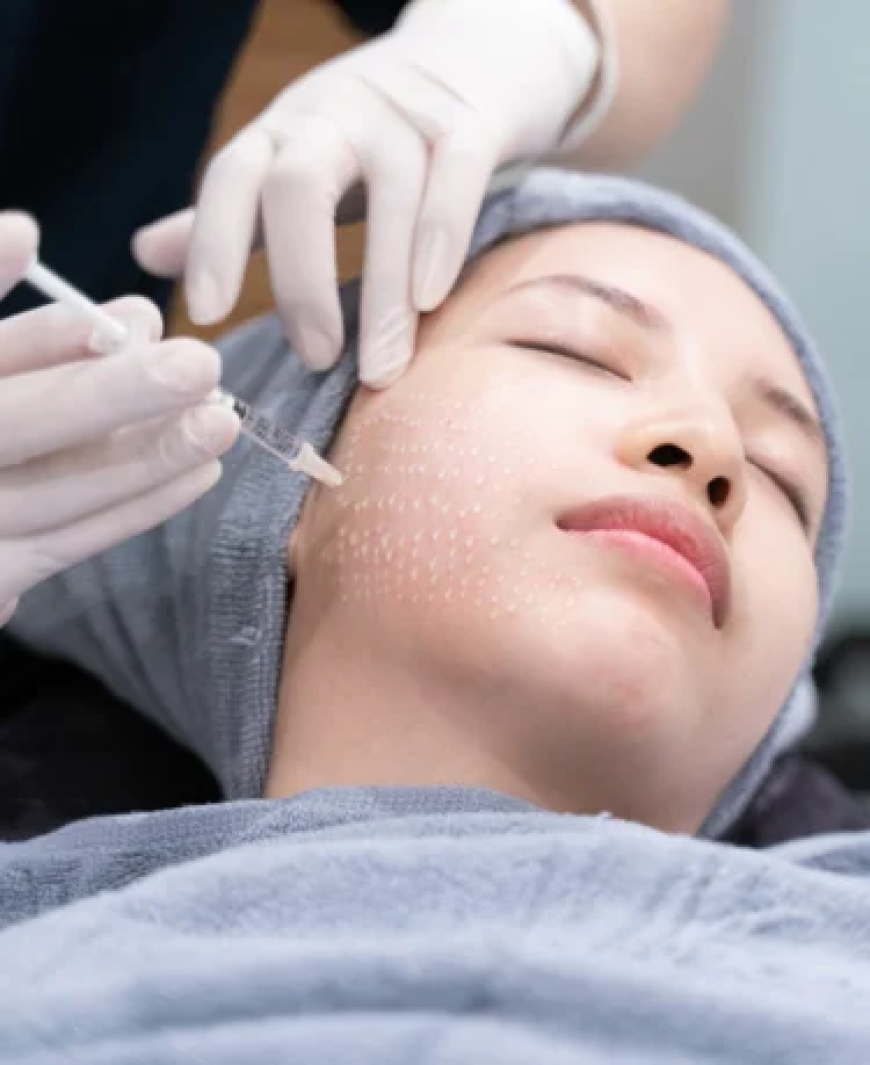 Mesotherapy Dubai: Your Path to Brighter, Firmer, and Healthier Skin
