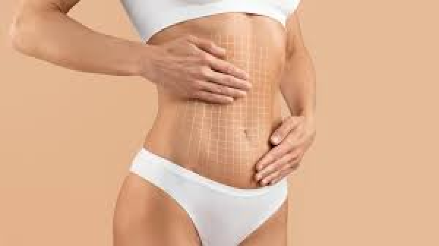 Best Liposuction Surgeon in Dubai Using Advanced Body Contouring Techniques