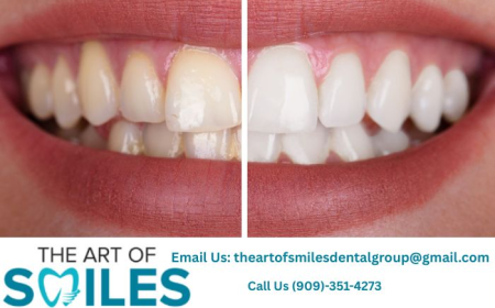 Emergency Dentist in Fontana | Fast & Trusted Dental Care Near You