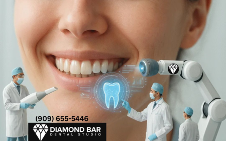 Dental Veneers in Diamond Bar | Dentist in Diamond Bar | Smile Makeovers