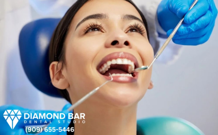 Diamond Bar Dental Group Focused on Healthy, Confident Smiles