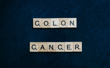 Everyday Risk Factors That Often Go Overlooked in Colorectal Cancer 