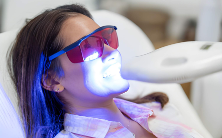 How to Maintain Your Teeth Whitening Results, Tips from Sundance Dental Grants