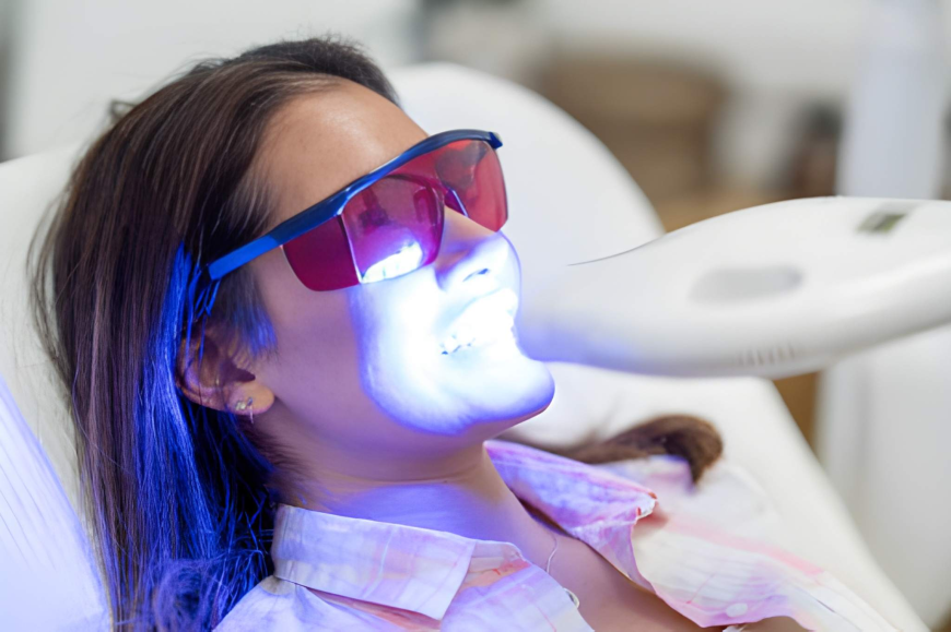 How to Maintain Your Teeth Whitening Results, Tips from Sundance Dental Grants
