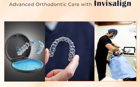 A Complete Guide Invisalign Treatment Cost in Hyderabad, India