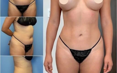 Innovative Body Contouring by Best Body Contouring Surgeons in Dubai