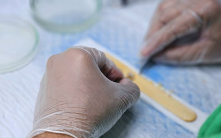 Hair Loss in Women: Causes, Diagnosis, and Treatment