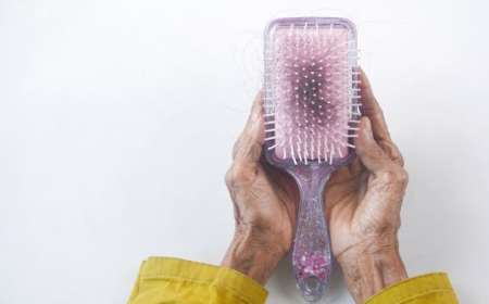 Everything You Need to Know About Hair Transplant