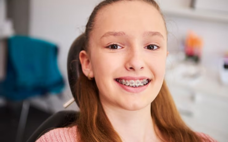 Fast Braces vs Traditional Braces: What’s the Difference?