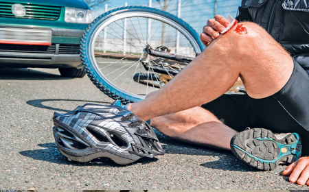 What Happens If You Don’t Hire a Bicycle Accident Lawyer After a Bike Crash?