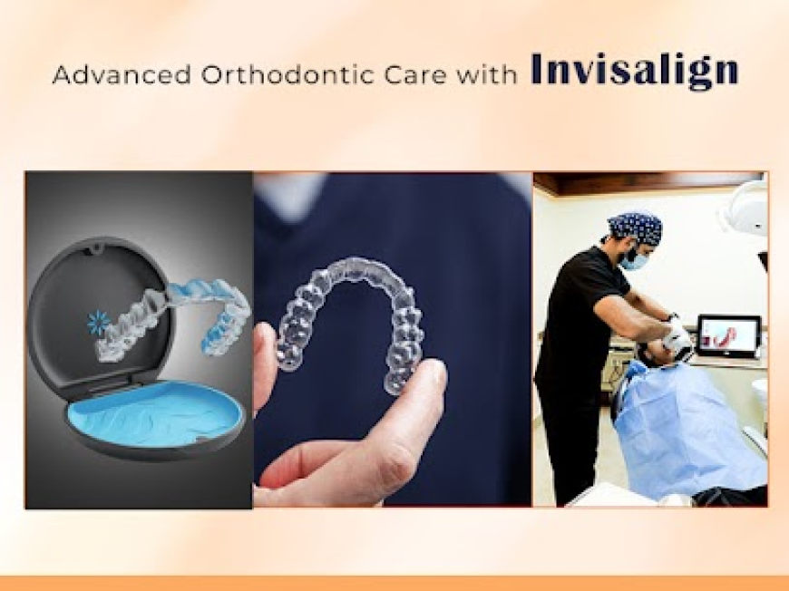A Complete Guide Invisalign Treatment Cost in Hyderabad, India