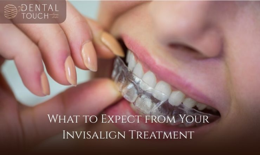 What to Expect from Your Invisalign Treatment