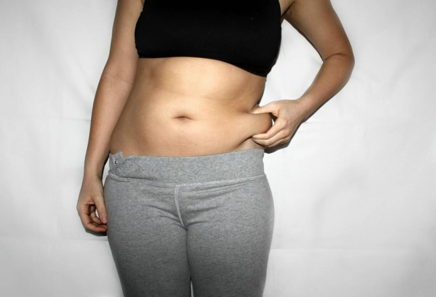 Natural Results: Lower Body Lift Treatment in Islamabad