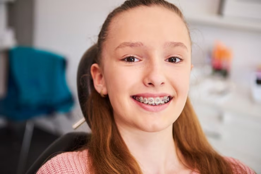 Fast Braces vs Traditional Braces: What’s the Difference?