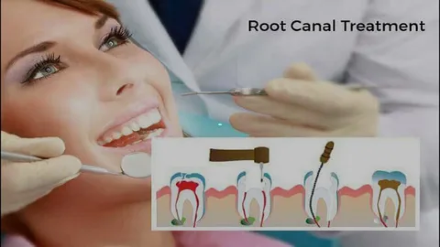 Root Canal Specialist In Murphy – Gentle, Affordable Tooth Pain Relief