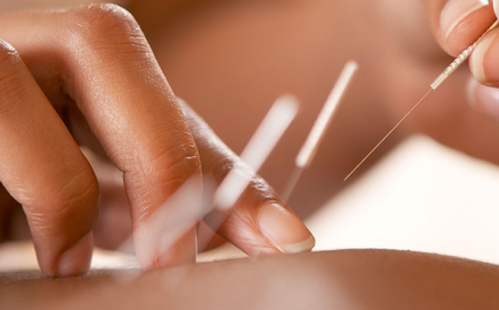 Acupuncture vs. Conventional Medicine: Which Works Better for Low Back Pain?