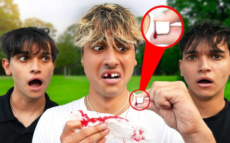 What Do I Do If My Tooth Was Knocked Out?