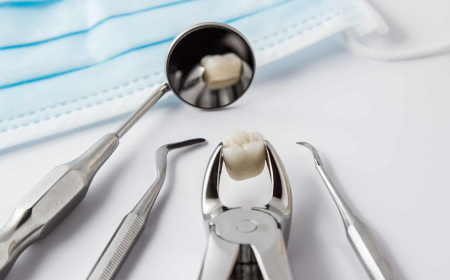 Transform Your Smile with Innovative All-on-4 Dental Implants in Bakersfield