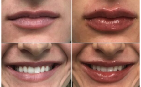 Best Medical Spa in Allentown, Bethlehem & Lehigh Valley