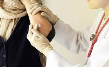 Managing Chronic Health Conditions That Affect the Skin