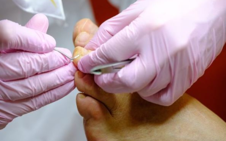 Reliable Podiatrist in Bondi Junction for All Ages Foot Concerns