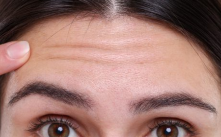 Anti Wrinkle Treatment Cost in the UK: Pricing, Factors and Is It Worth It?