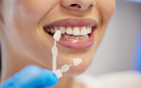 Why Choosing a Local Dentist in West Ryde Is Essential for Your Oral Health