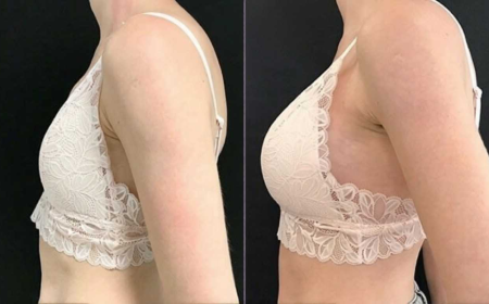 Complete Breast Enlargement Injections in Islamabad