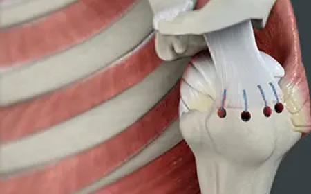 Top Shoulder Surgeons in Michigan: Procedures, Costs & Patient Outcomes