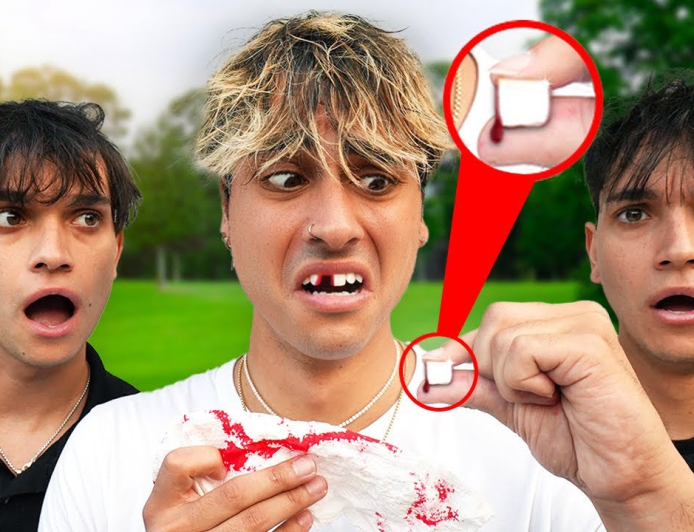 What Do I Do If My Tooth Was Knocked Out?