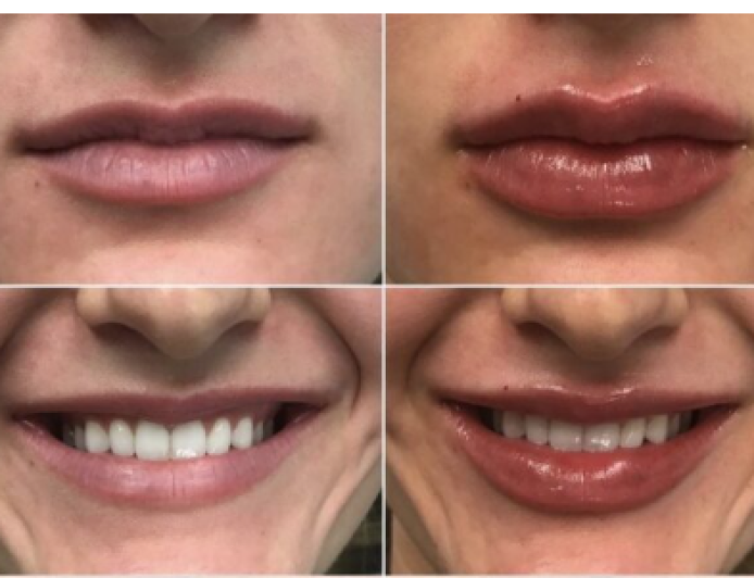 Best Medical Spa in Allentown, Bethlehem & Lehigh Valley