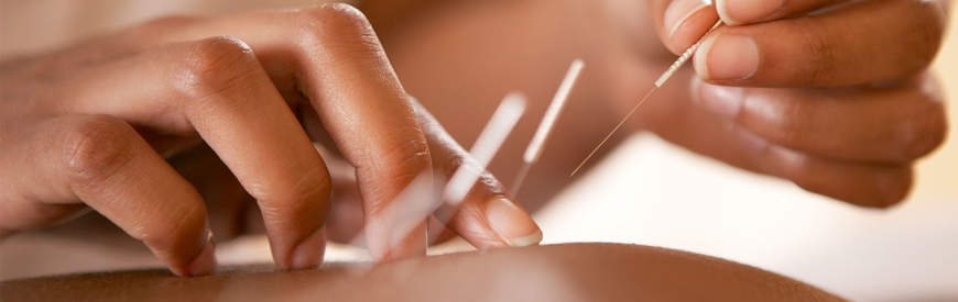Acupuncture vs. Conventional Medicine: Which Works Better for Low Back Pain?