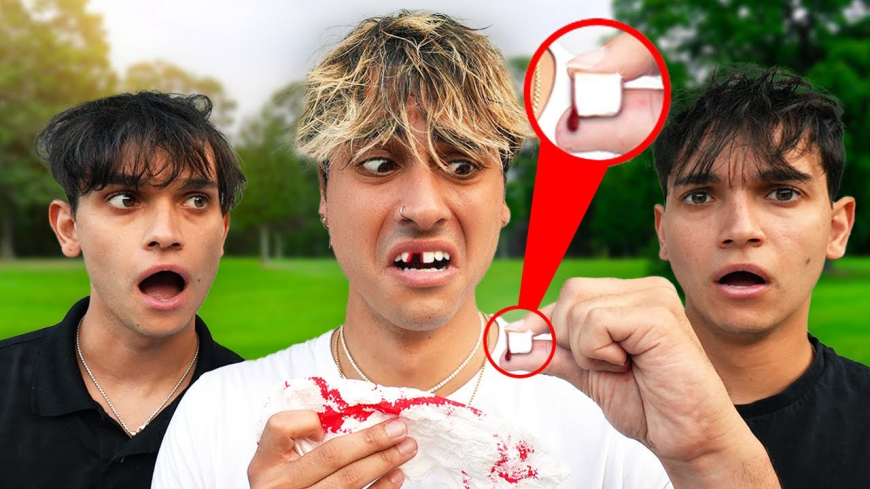 What Do I Do If My Tooth Was Knocked Out?