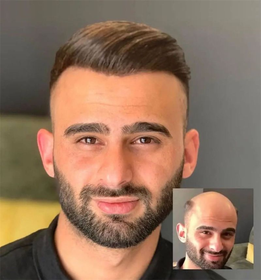 What Is a Hair Wig for Men and How Can It Instantly Change Your Look?