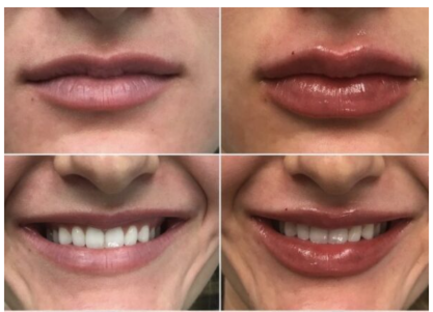 Best Medical Spa in Allentown, Bethlehem & Lehigh Valley