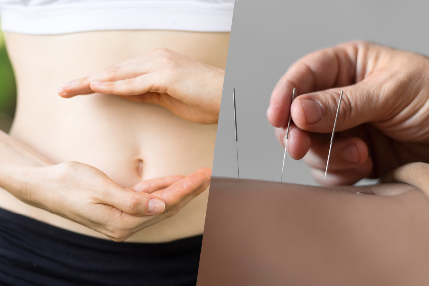 Can Acupuncture Help You Lose Weight Without Extreme Diets?