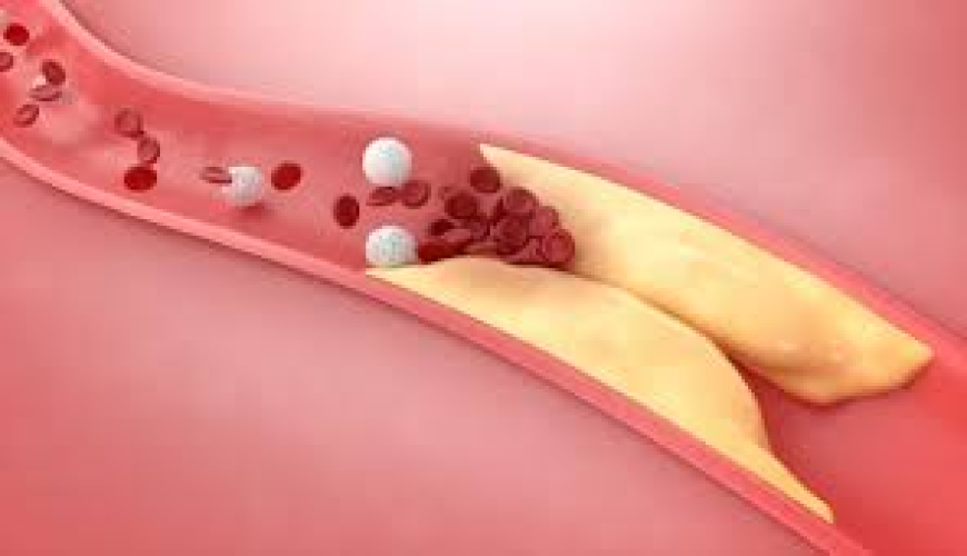 Medications for High Cholesterolemia Dubai: What You Should Know