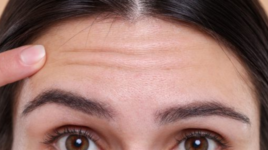 Anti Wrinkle Treatment Cost in the UK: Pricing, Factors and Is It Worth It?