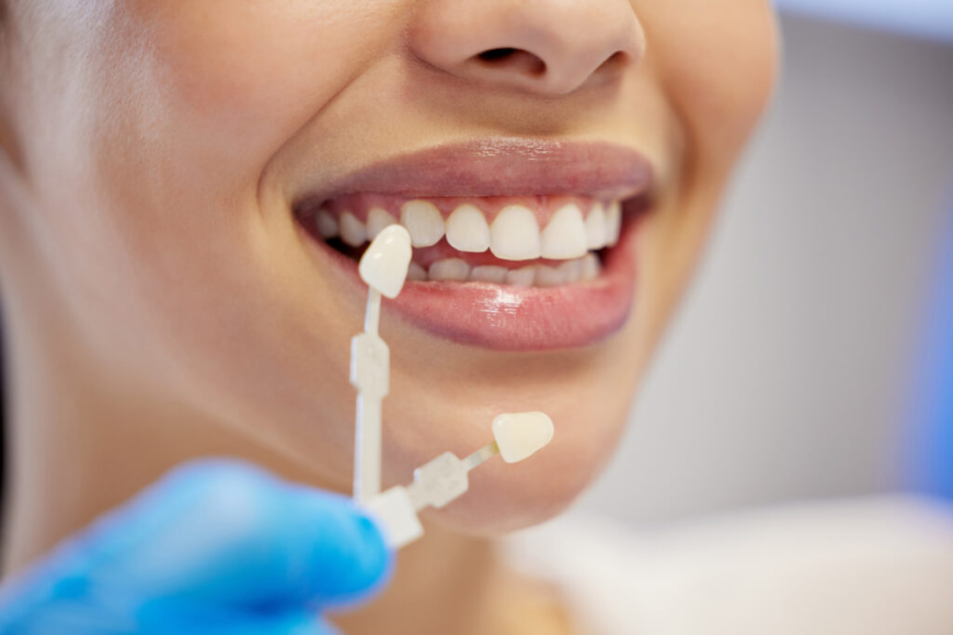 Why Choosing a Local Dentist in West Ryde Is Essential for Your Oral Health
