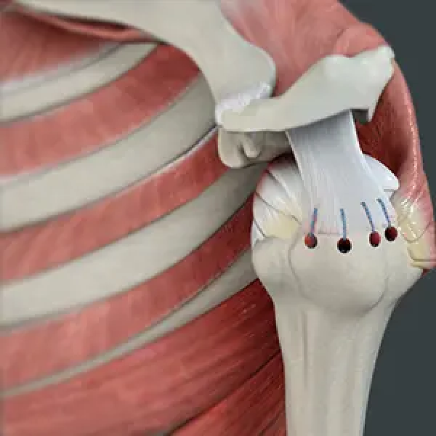 Top Shoulder Surgeons in Michigan: Procedures, Costs & Patient Outcomes