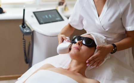 Laser vs. Peels – Best Option for Melasma in Manchester