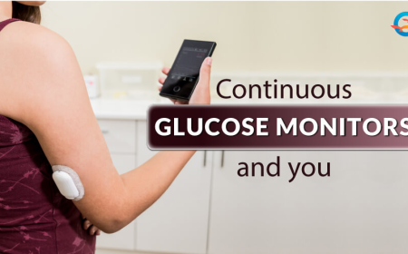 Continuous Glucose Monitors – Things You Need to Know Before Use